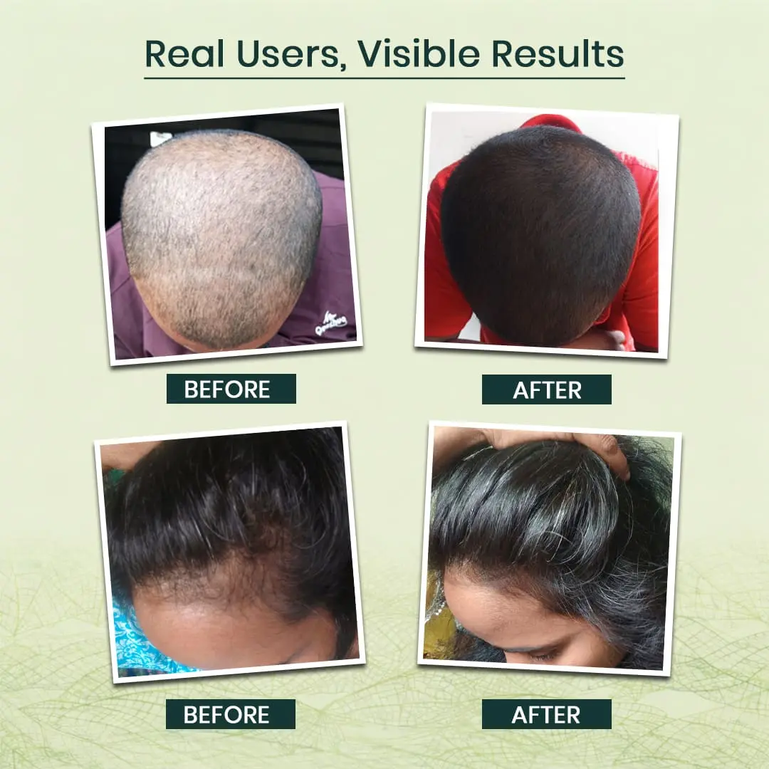 Vigoraahi Herbal Adikeshakanthi Herbal Hair Oil Product Slider 2